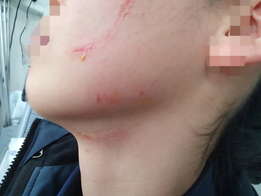 청주여자교도소 체험기: 과밀 수용과 교화 기능의 현실