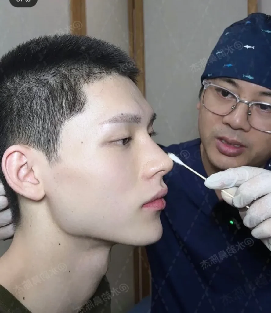 남자 코 수술의 전설적인 사례
