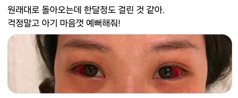 자연분만 후 산모들의 상태 (사진 주의).