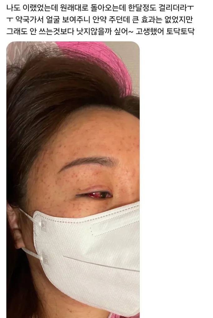 자연분만 후 산모들의 상태 (사진 주의).