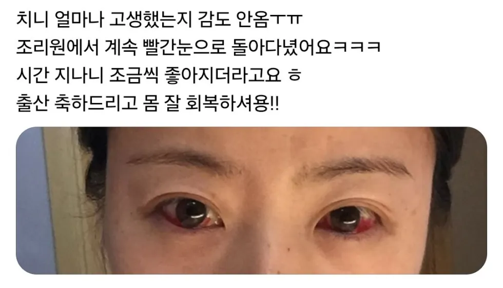 자연분만 후 산모들의 상태 (사진 주의).