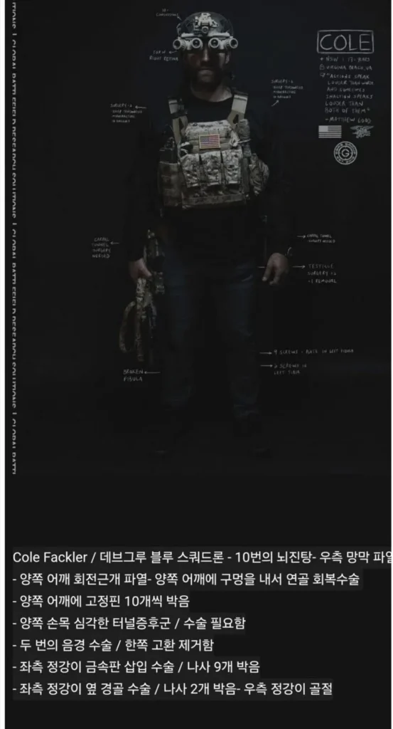 17년간 특수부대 복무한 군인의 신체 상태