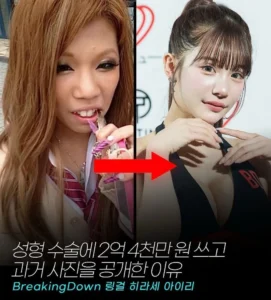 일본 인플루언서, 2억 4천만원 성형 후 과거 사진 공개