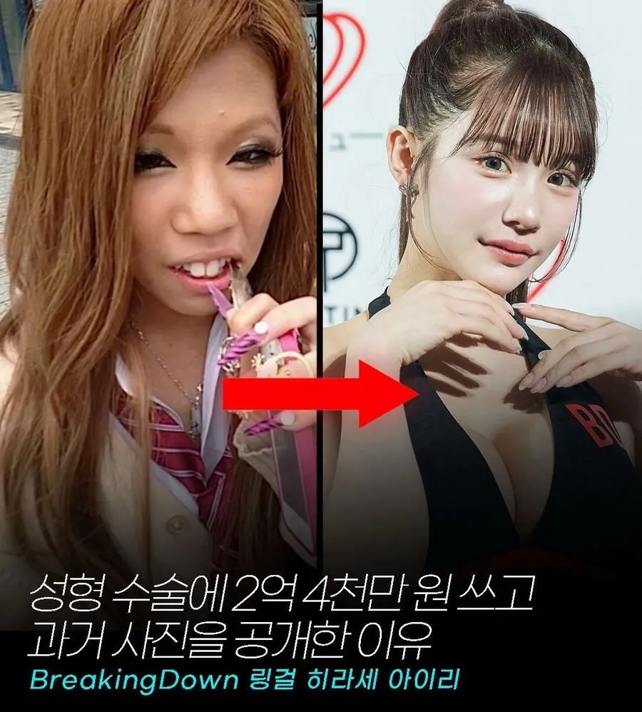 일본 인플루언서, 2억 4천만원 성형 후 과거 사진 공개