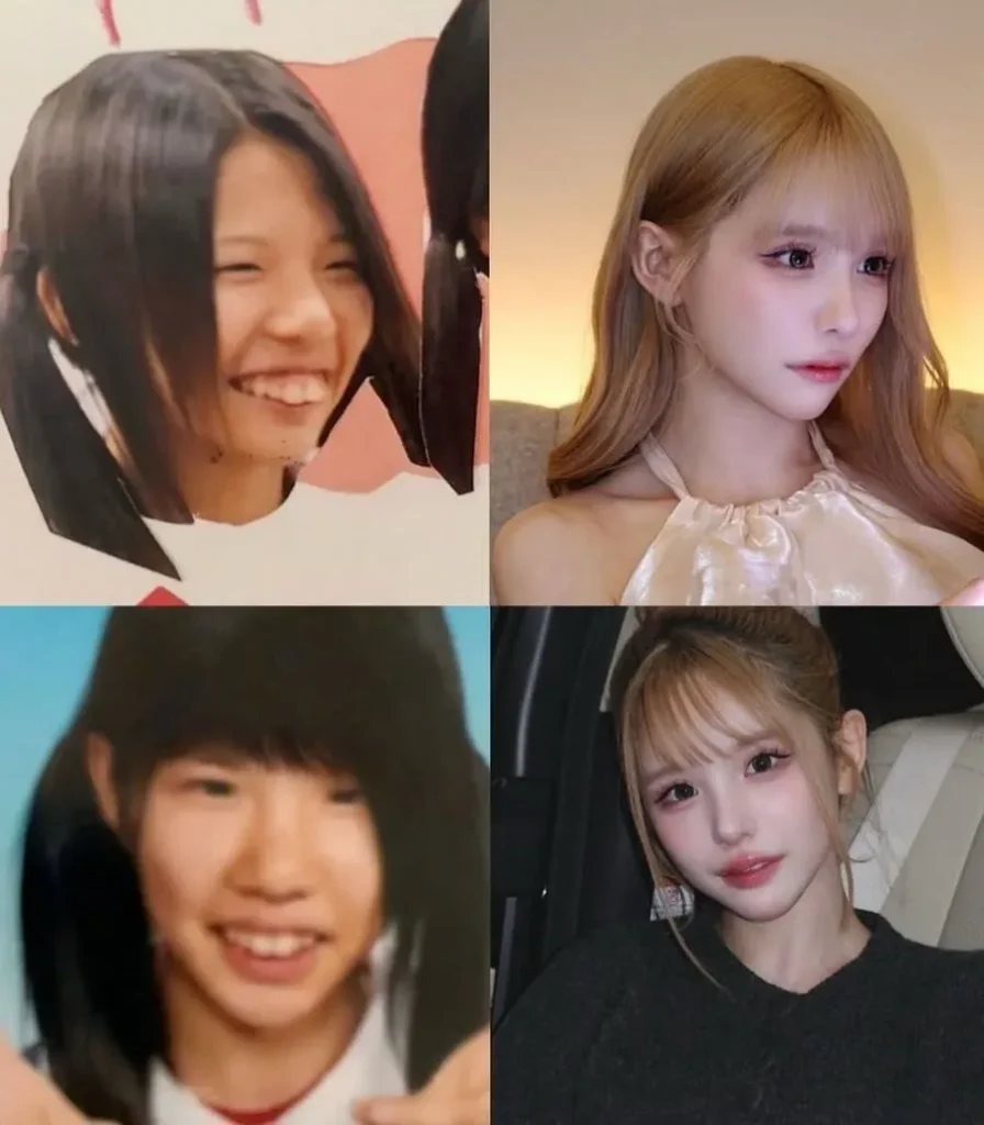 일본 인플루언서, 2억 4천만원 성형 후 과거 사진 공개