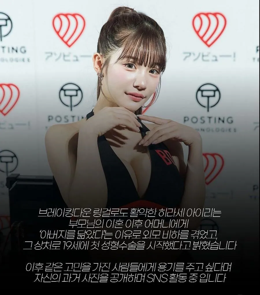 일본 인플루언서, 2억 4천만원 성형 후 과거 사진 공개
