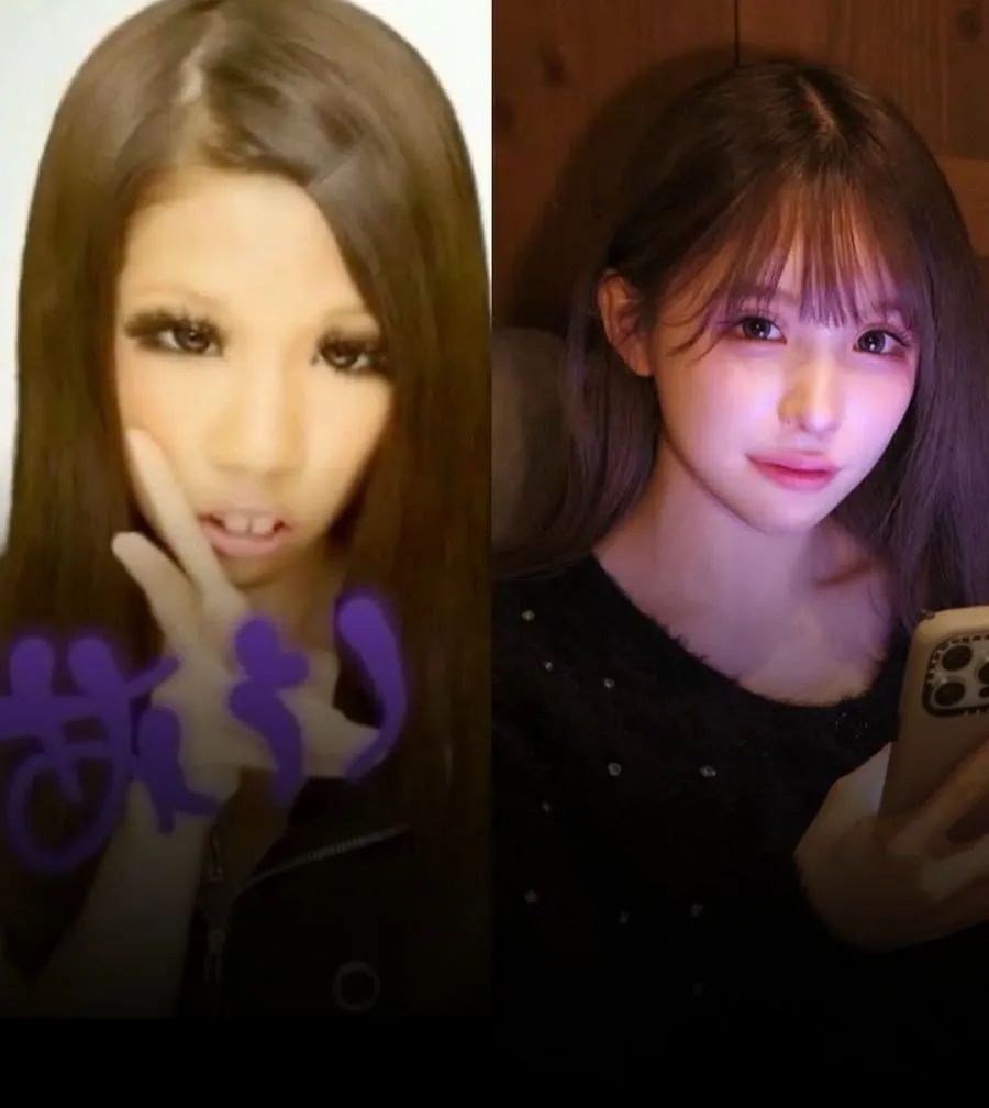 일본 인플루언서, 2억 4천만원 성형 후 과거 사진 공개