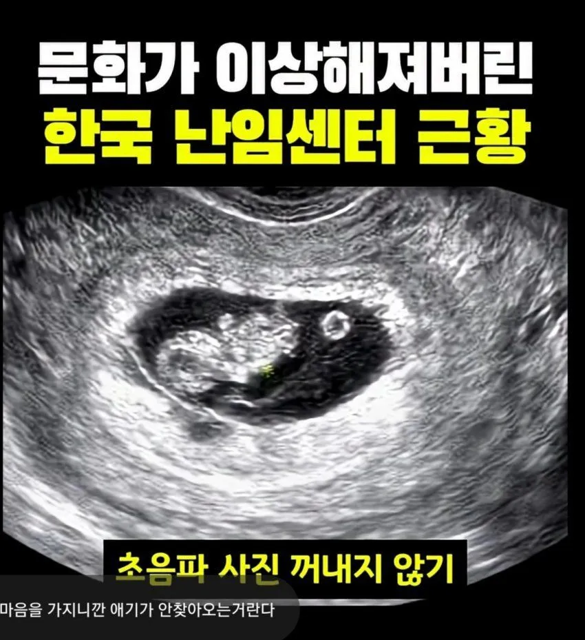 난임센터의 한국식 불문율