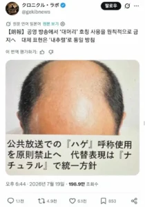 대머리라고 부르는 것을 금지합니다!!!!!!!!!!!!