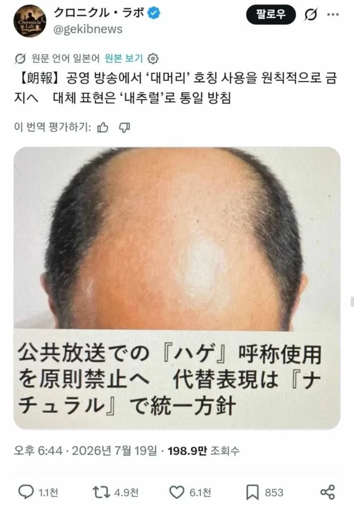 대머리라고 부르는 것을 금지합니다!!!!!!!!!!!!