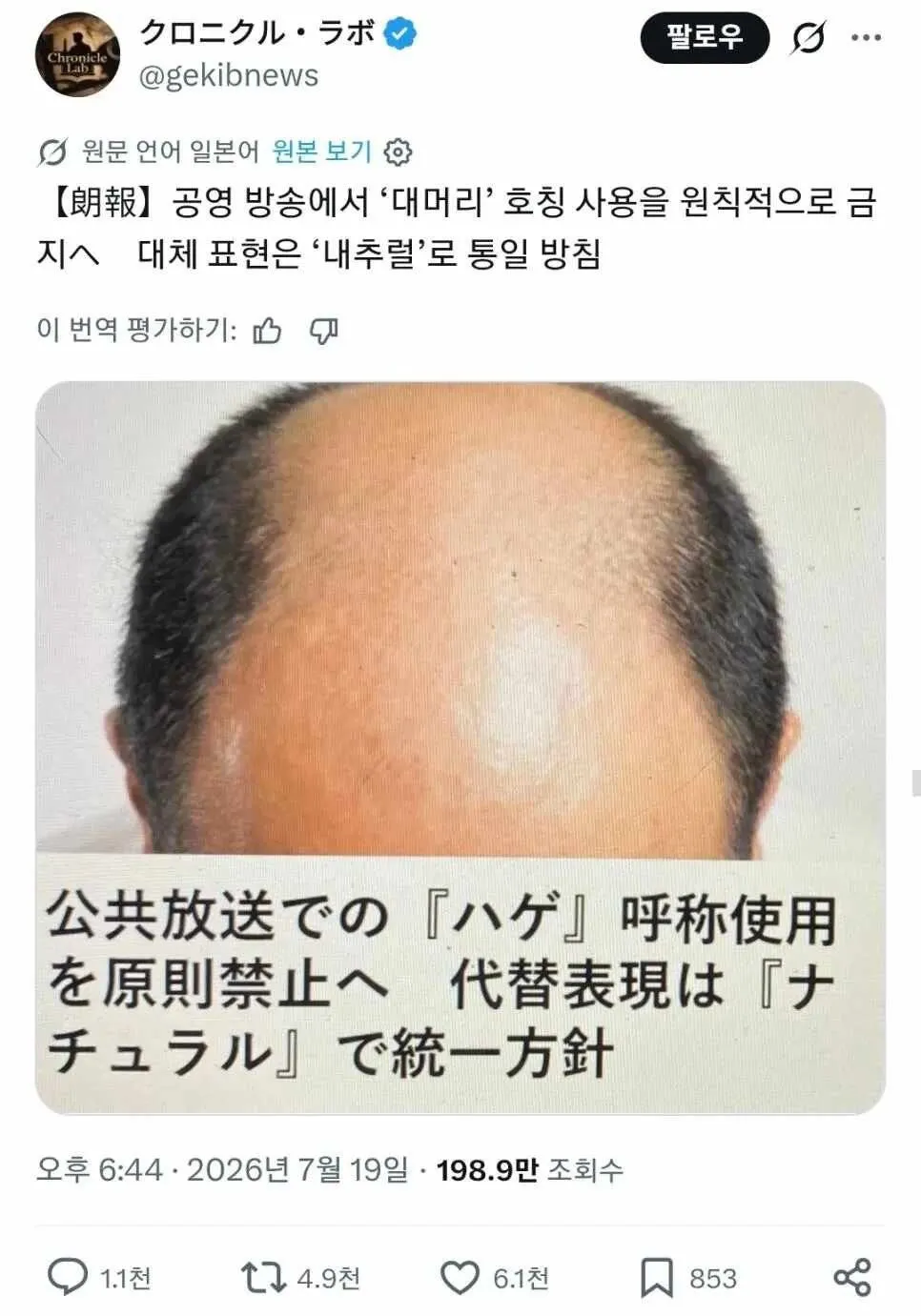 대머리라고 부르는 것을 금지합니다!!!!!!!!!!!!