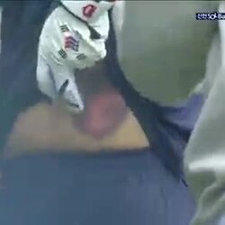 타자, 투수공 맞은 후 상태는?