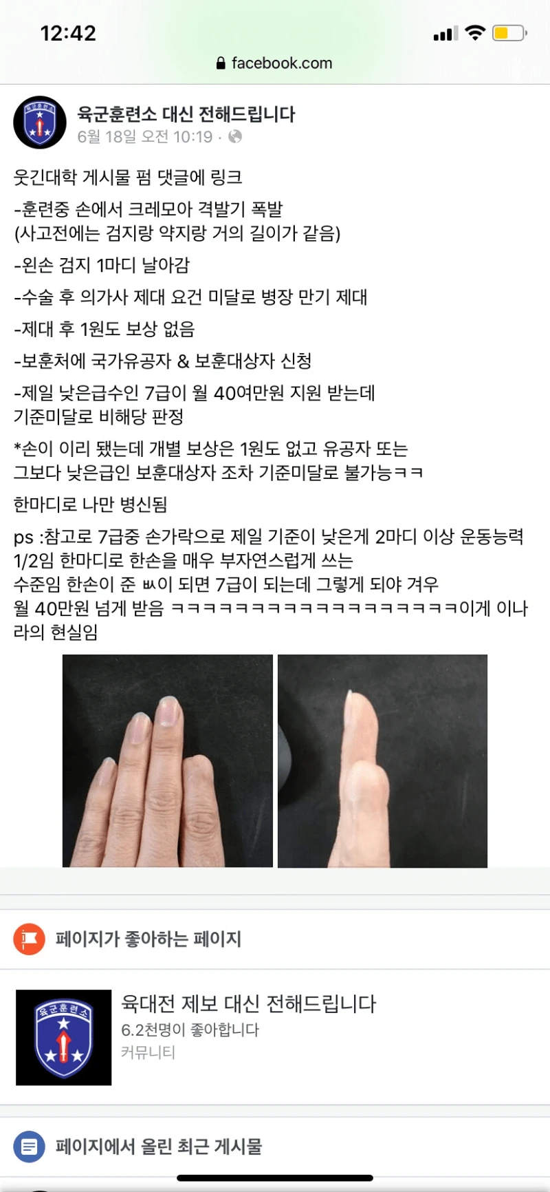 격발 시 크레모아 폭발 사고