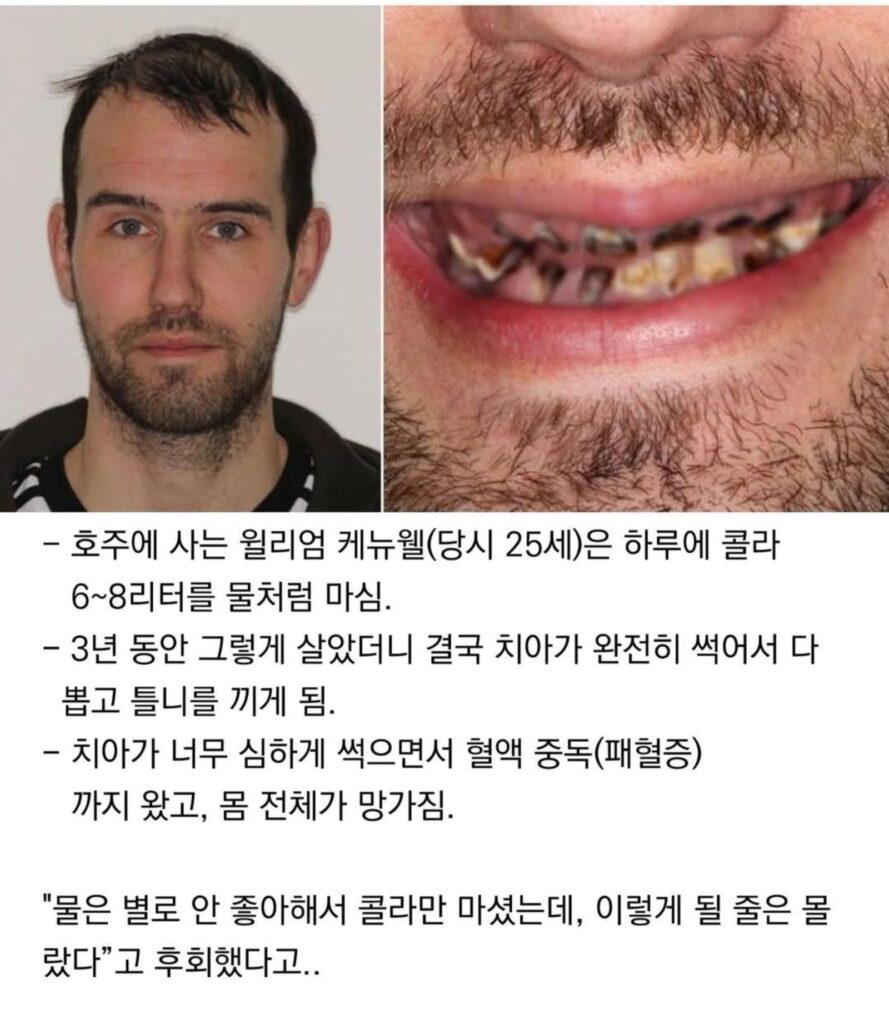 3년 동안 콜라를 마신 남자의 최후
