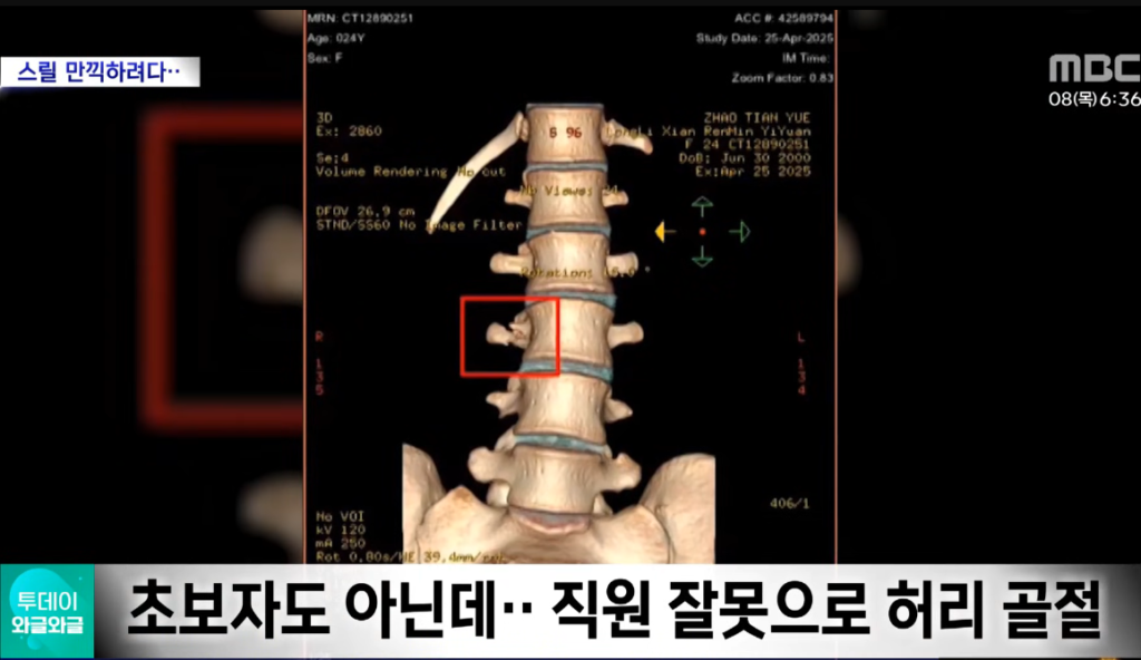 번지점프 중 발생한 사고