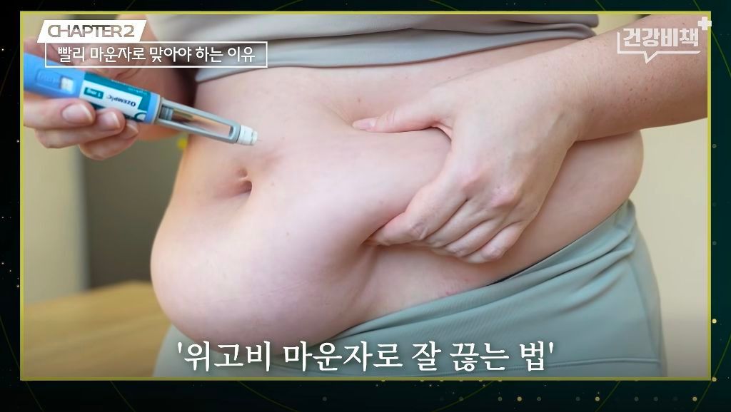 마운자로·위고비 처방 의사의 복용 지속 이유.jpg