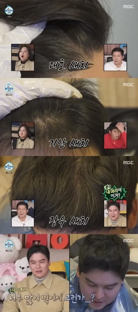 20대 중반 넘어서면 나타나기 시작하는 것들