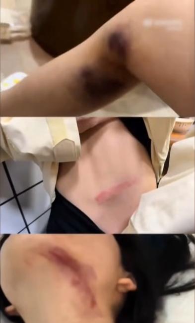 번지점프 중 발생한 사고