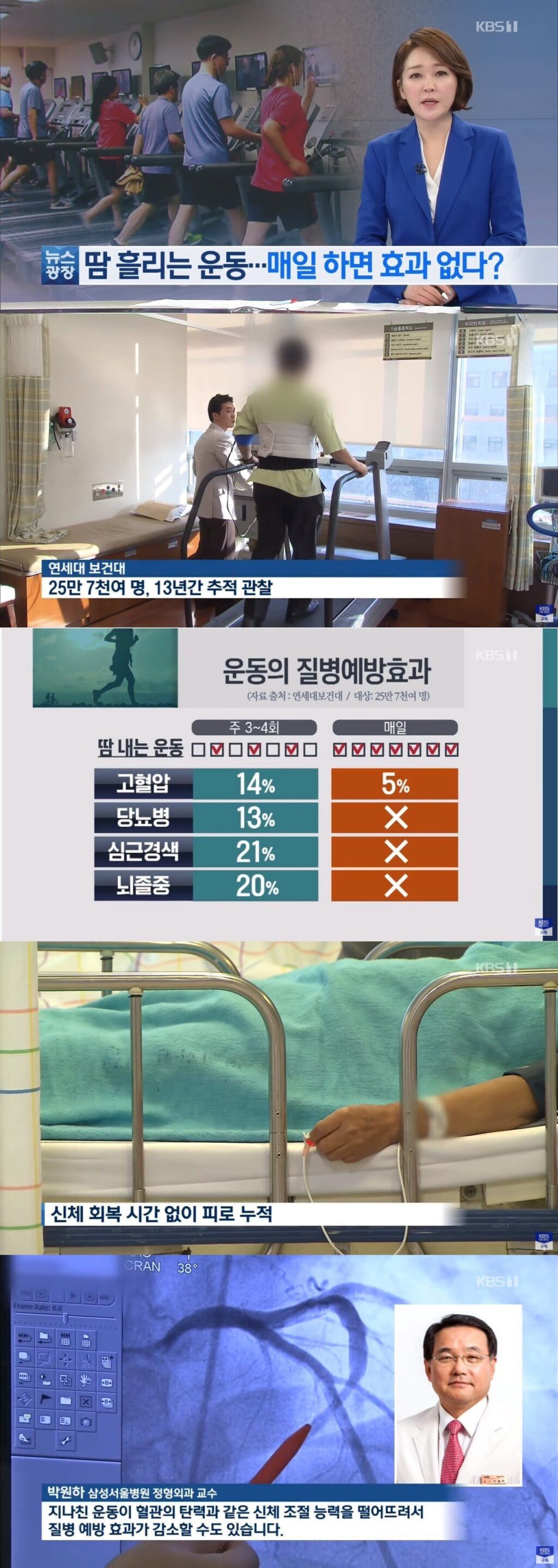 매일 운동이 건강에 좋지 않을 수 있는 이유