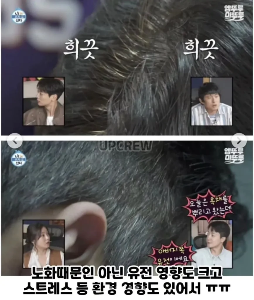 20대 중반 넘어서면 나타나기 시작하는 것들