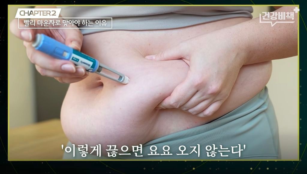 마운자로·위고비 처방 의사의 복용 지속 이유.jpg