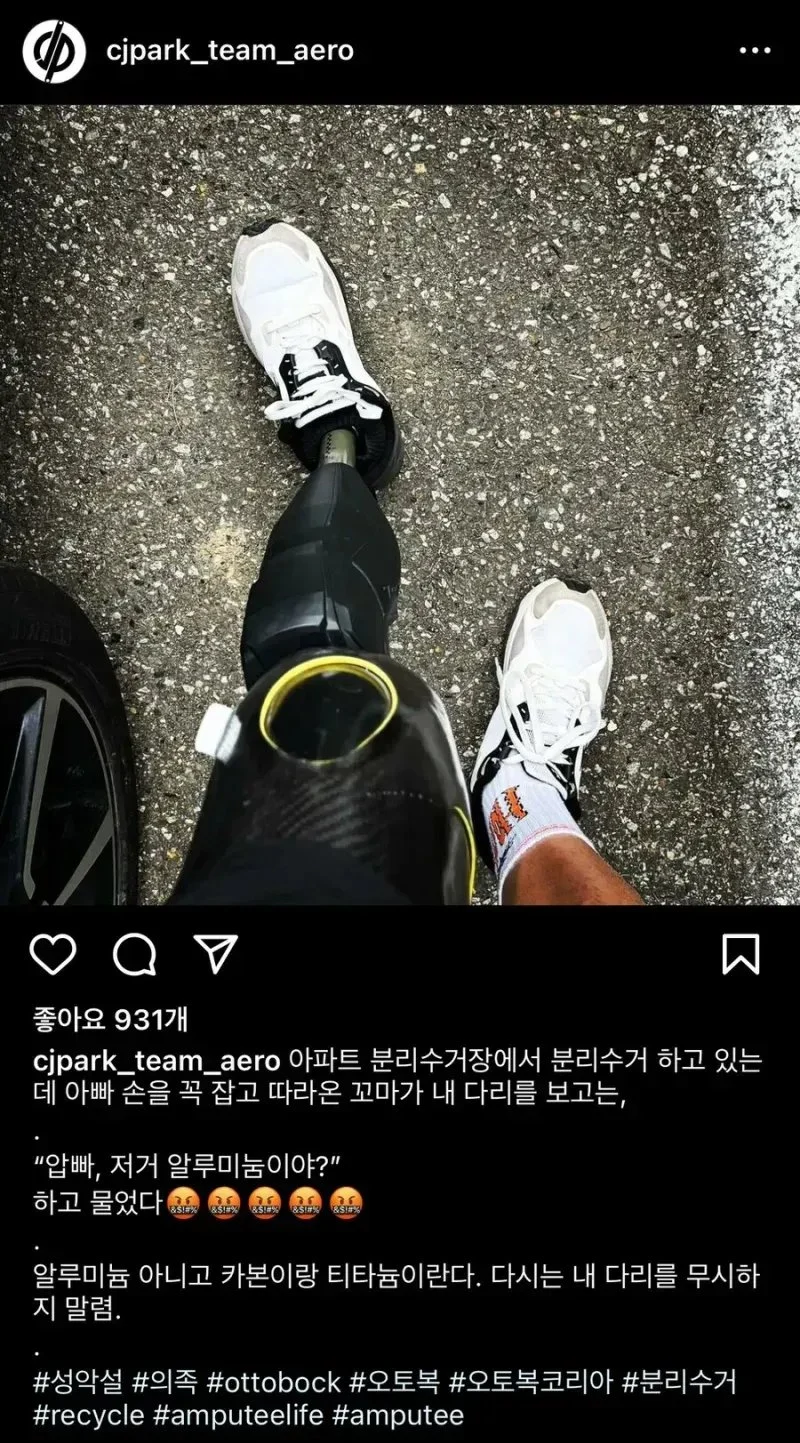 다리 없는 남성이 아이의 말에 상처받은 사연