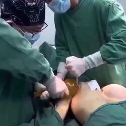 가슴수술 현장 혐오