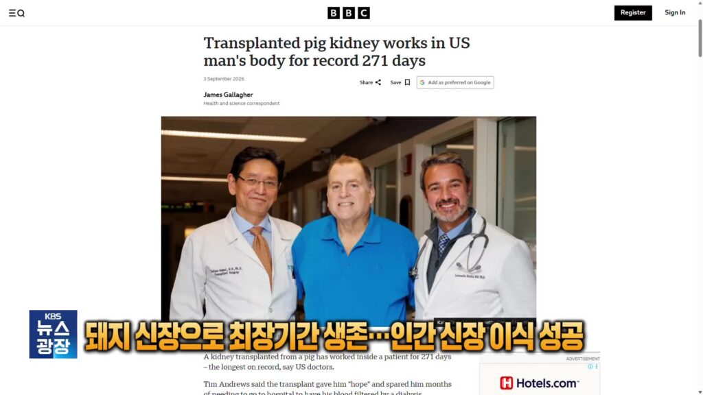 돼지 신장 9개월 기능 유지 후 인간 신장 이식 성공… 60대 남성 첫 사례