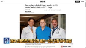 돼지 신장 9개월 기능 유지 후 인간 신장 이식 성공… 60대 남성 첫 사례