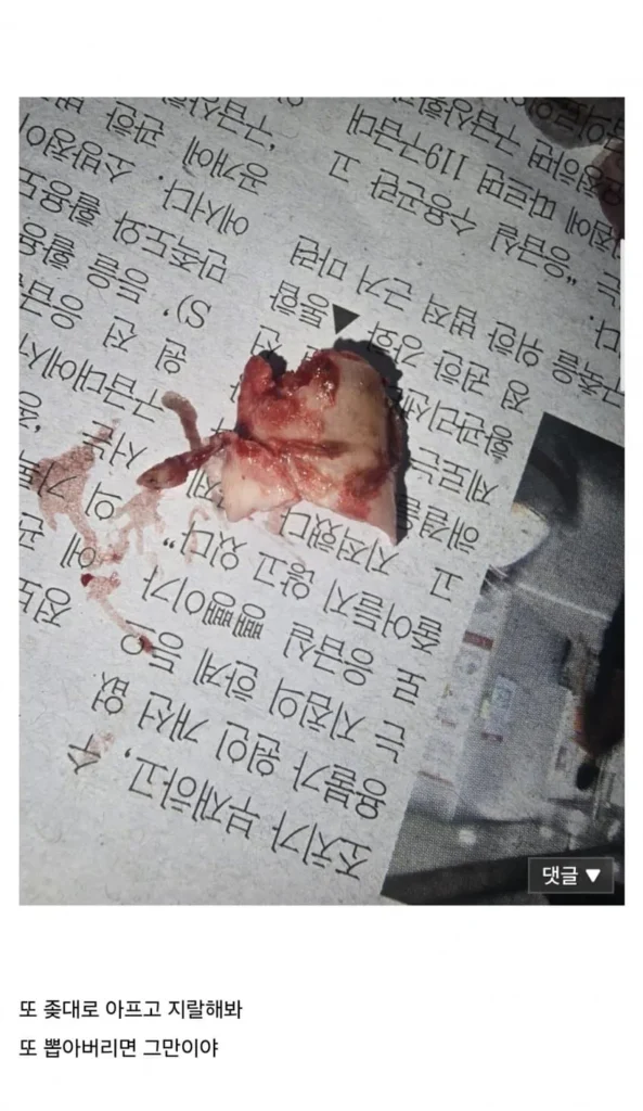 정신력을 엿볼 수 있는 갤러리 (혐주의)