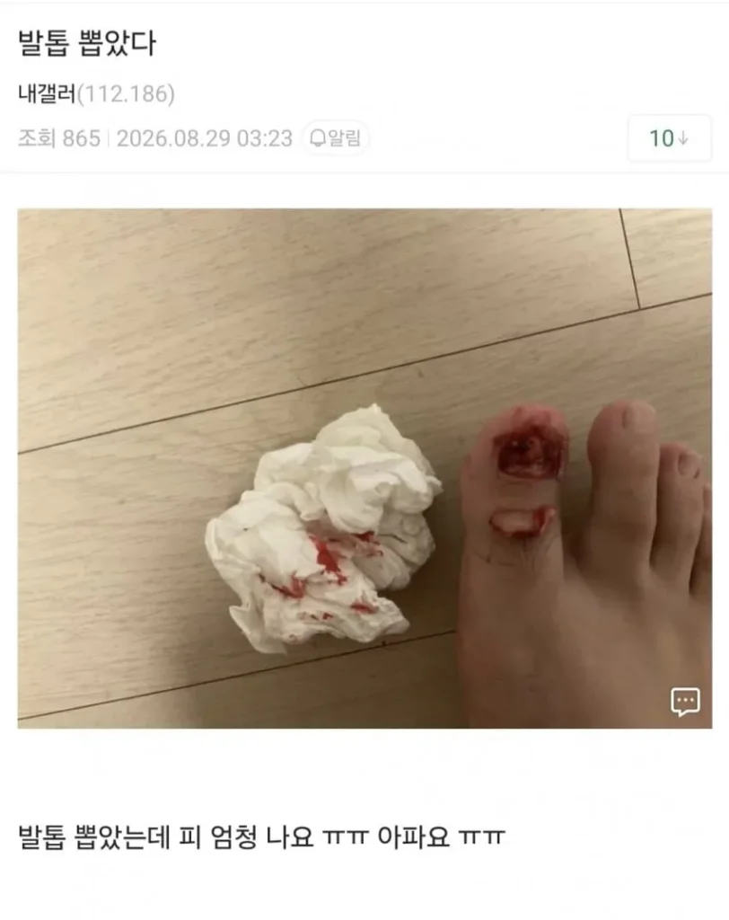 정신력을 엿볼 수 있는 갤러리 (혐주의)