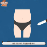 요즘 여성들에게 인기 있는 몸매 교정 시술