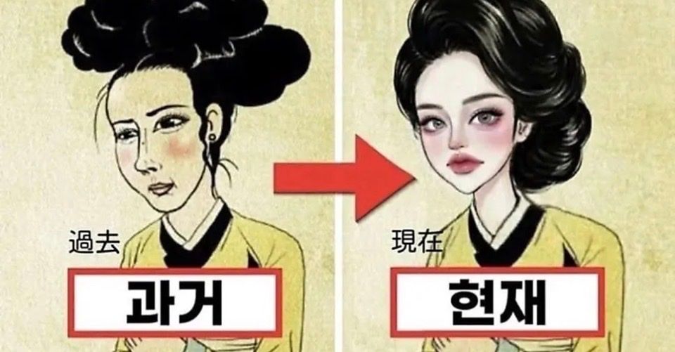 요즘 바뀐 성형 트랜드