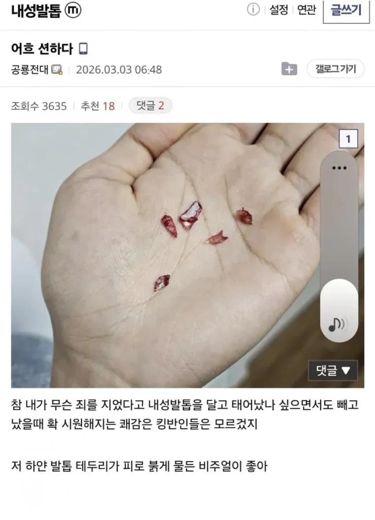 정신력을 엿볼 수 있는 갤러리 (혐주의)
