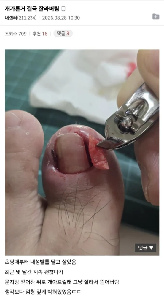 정신력을 엿볼 수 있는 갤러리 (혐주의)