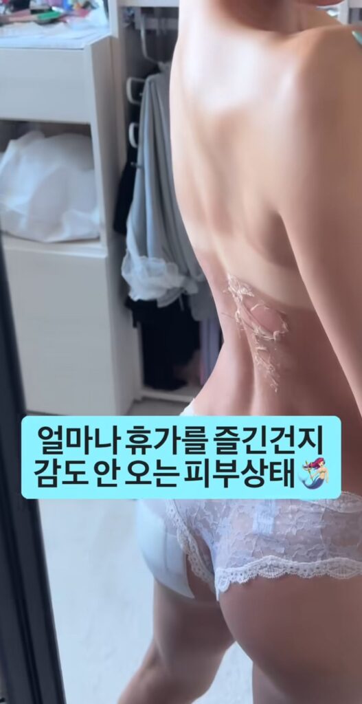 휴가 후 여자의 피부 상태 변화