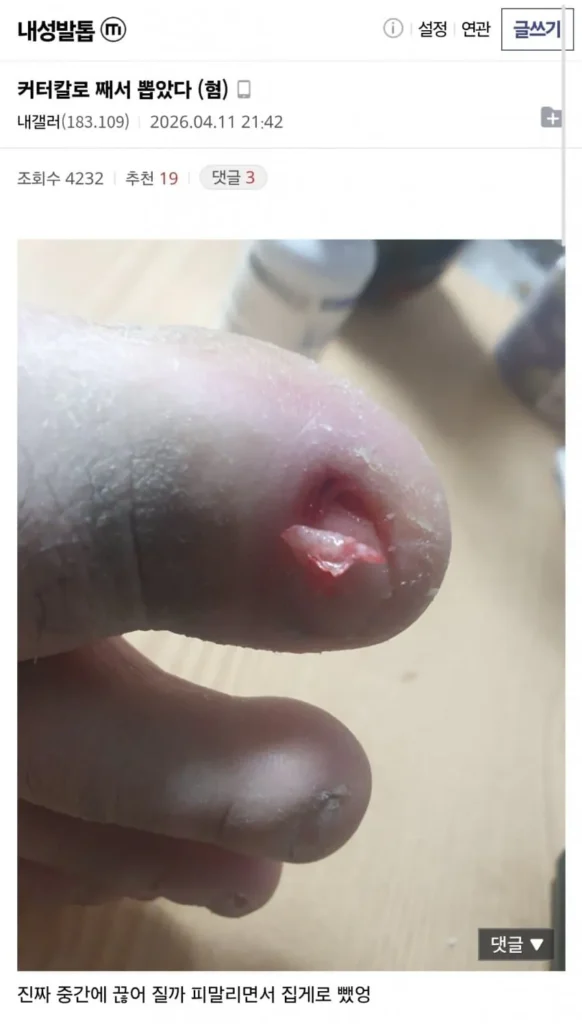 정신력을 엿볼 수 있는 갤러리 (혐주의)