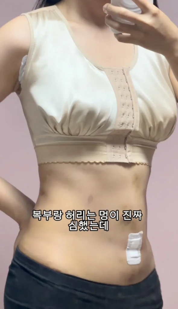 요즘 여성들에게 인기 있는 몸매 교정 시술