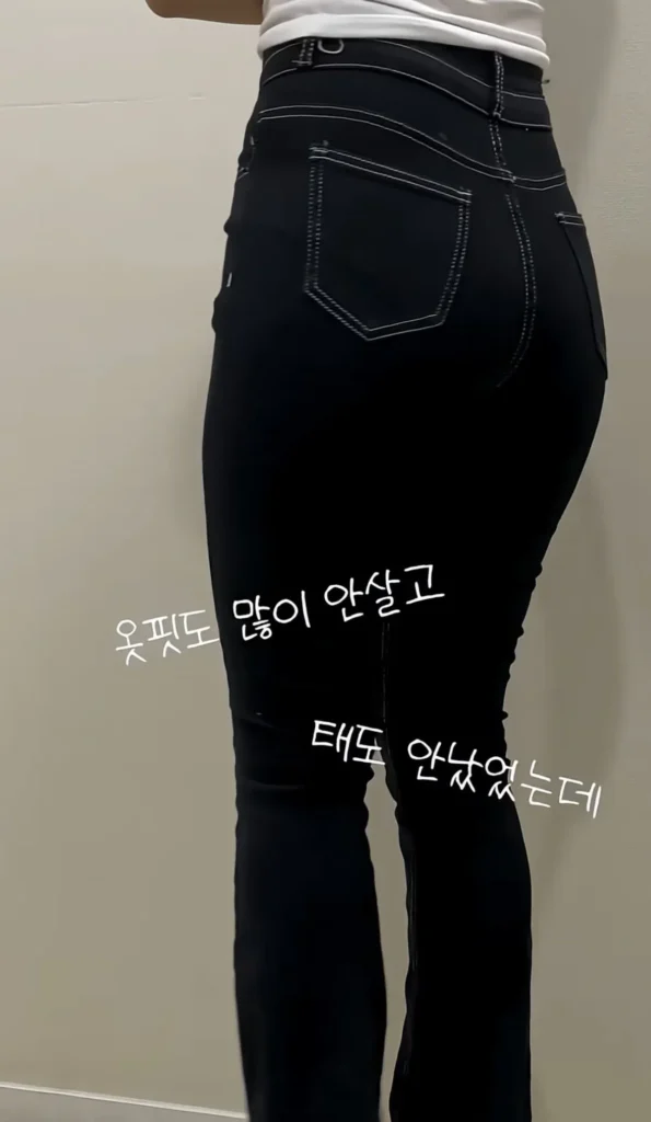 요즘 여성들에게 인기 있는 몸매 교정 시술