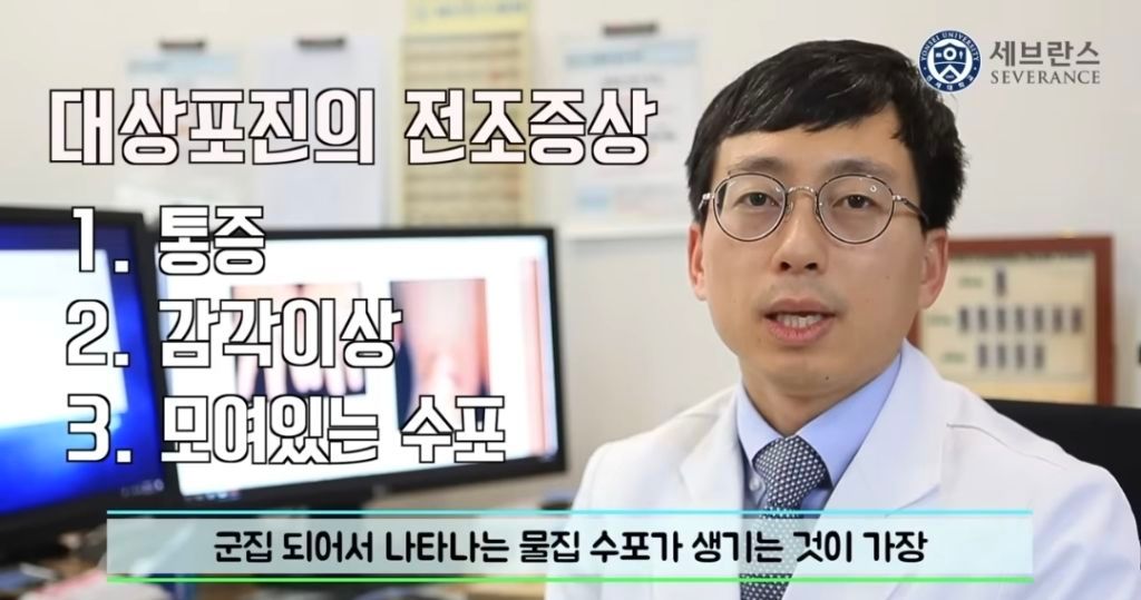 대상포진 전조 증상 알아보기
