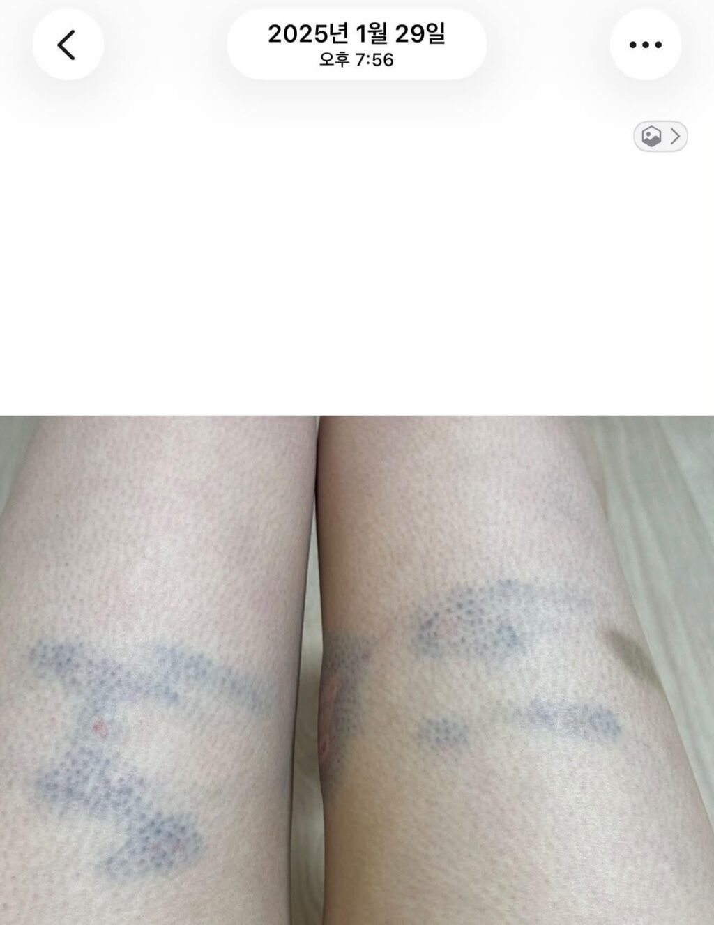 논란중인 버거킹 매니저 폭행 사건