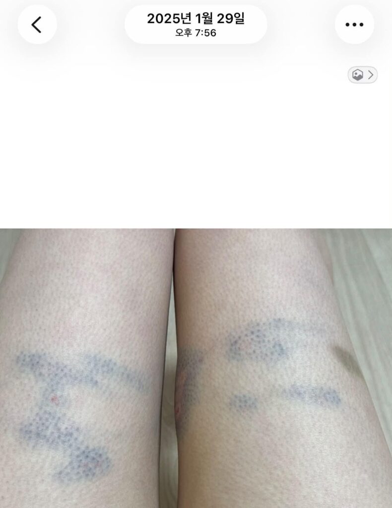 논란중인 버거킹 매니저 폭행 사건