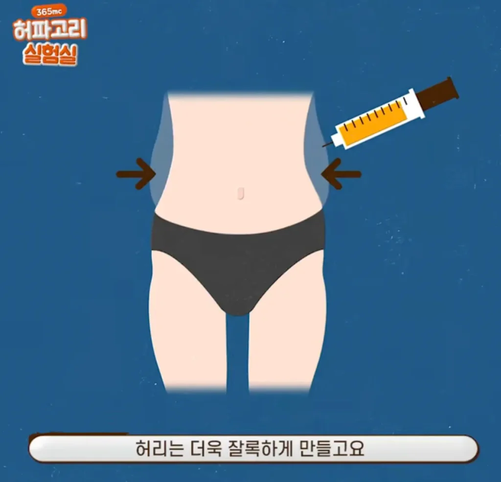 요즘 여성들에게 인기 있는 몸매 교정 시술