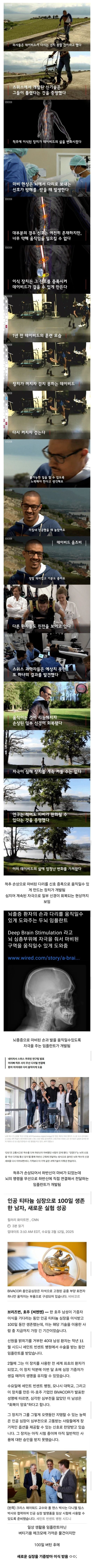 AI 도움으로 뇌 칩 이식, 루게릭병 환자 대화 가능케 한 과학계의 진전