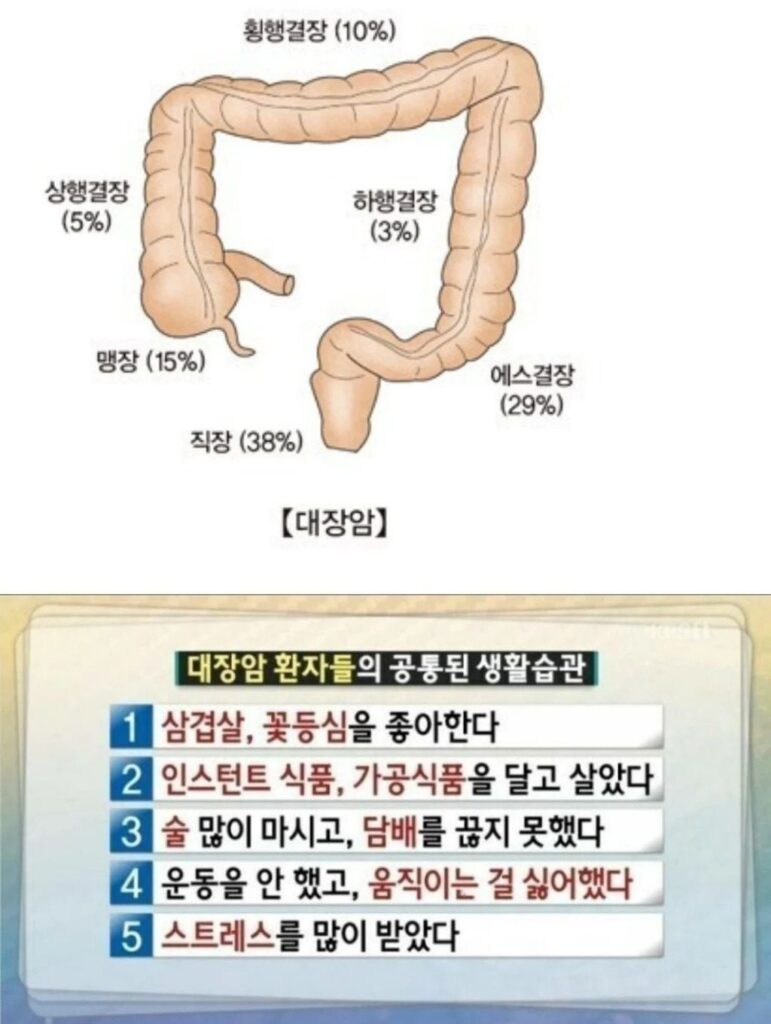 대장암 환자가 흔히 보이는 생활 습관.
