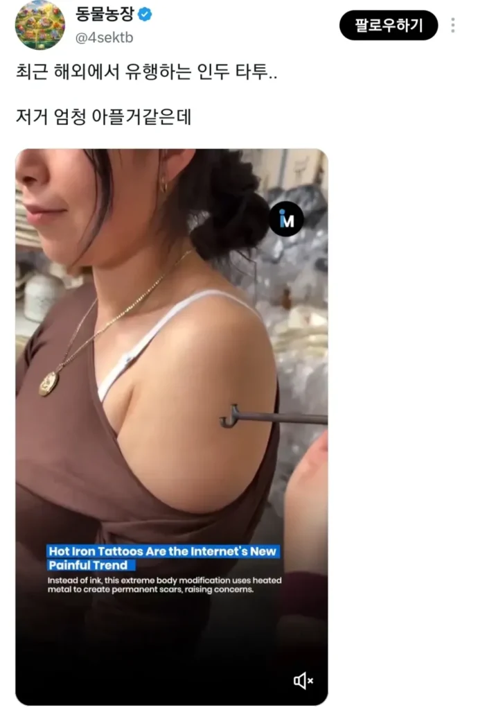 최근 해외에서 일부 사람들에게 유행하는 인두 타투.jpg