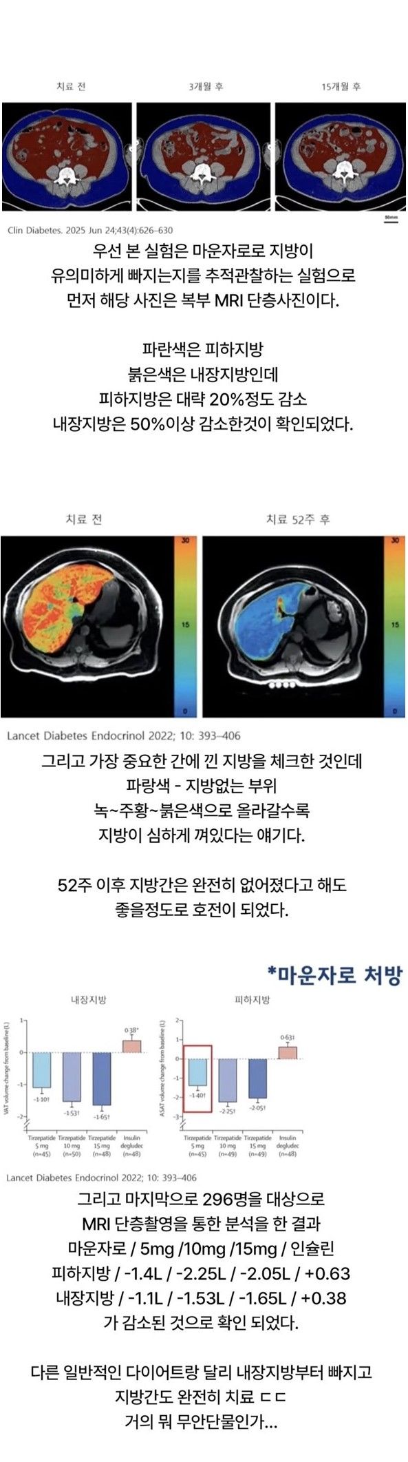 마운자로 1년 맞았더니 내장지방에 생긴 변화