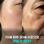 70세 피부 30세 수준으로 되돌릴수 있다?