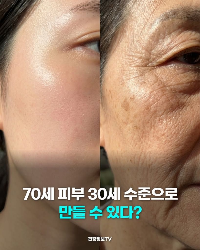 70세 피부 30세 수준으로 되돌릴수 있다?