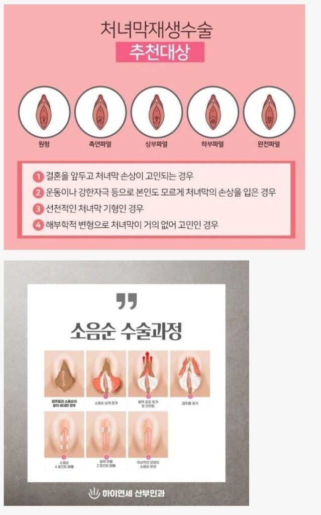 19) 여자들의 신분세탁